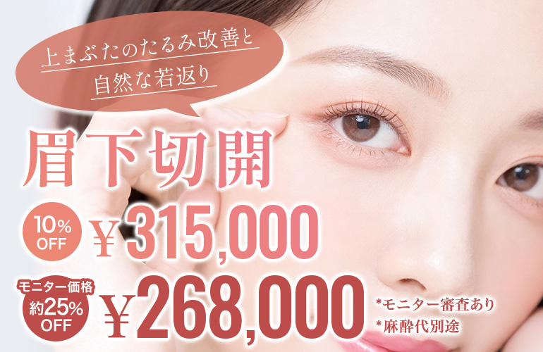 キャンペーン価格　今すぐWEB予約する