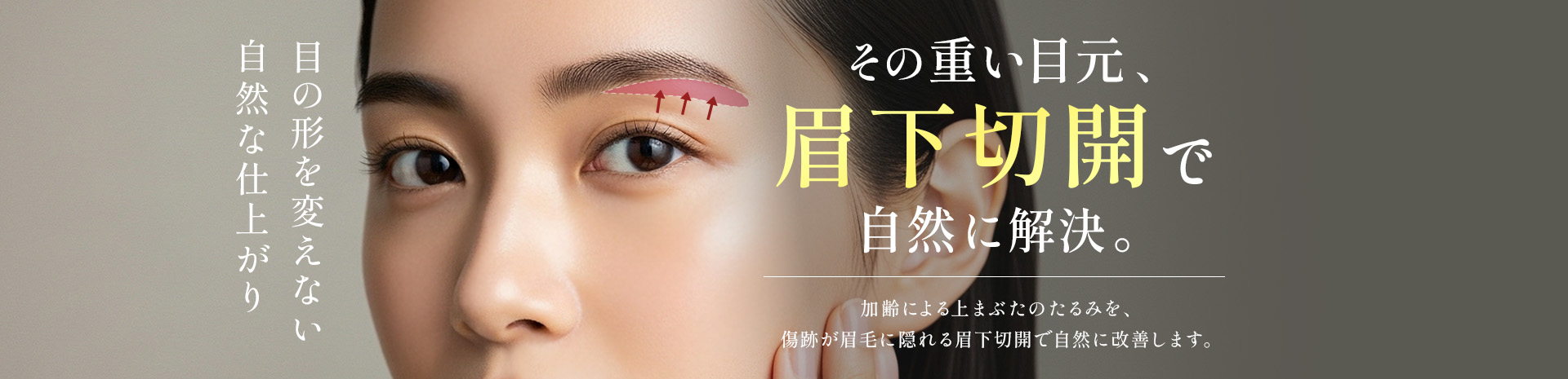 眉下切開