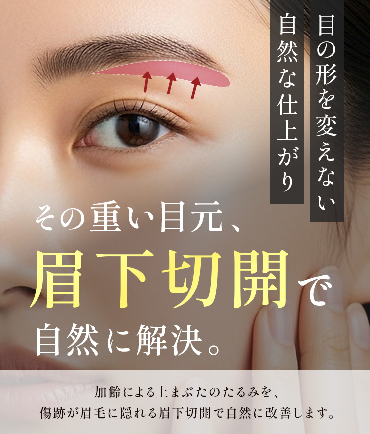 眉下切開
