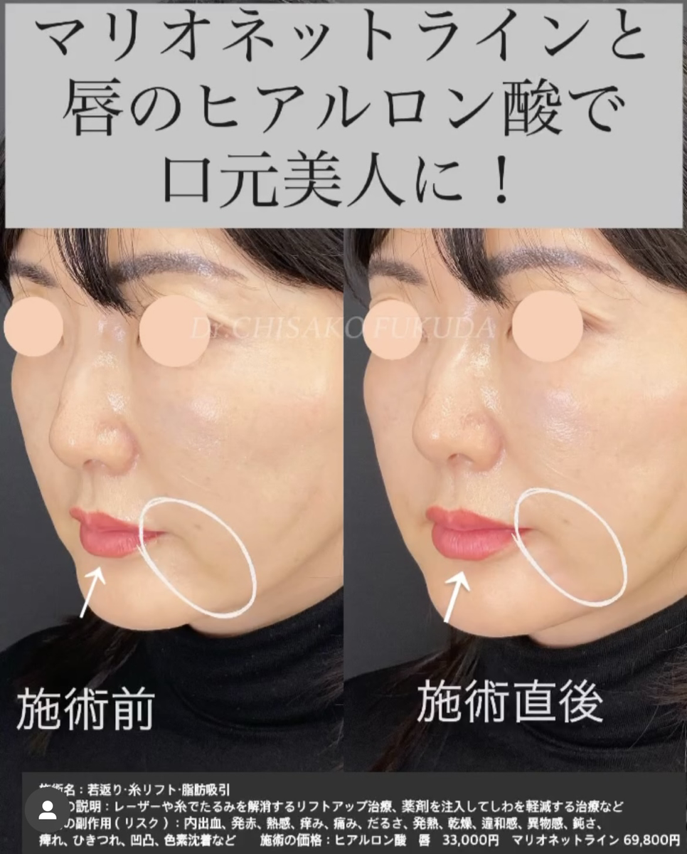 症例画像
