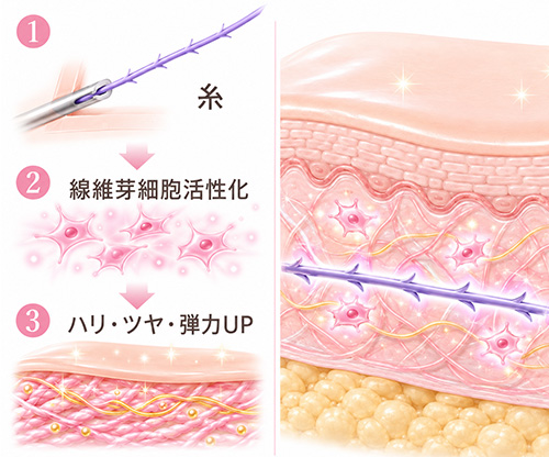 バイオスティミュレーション効果