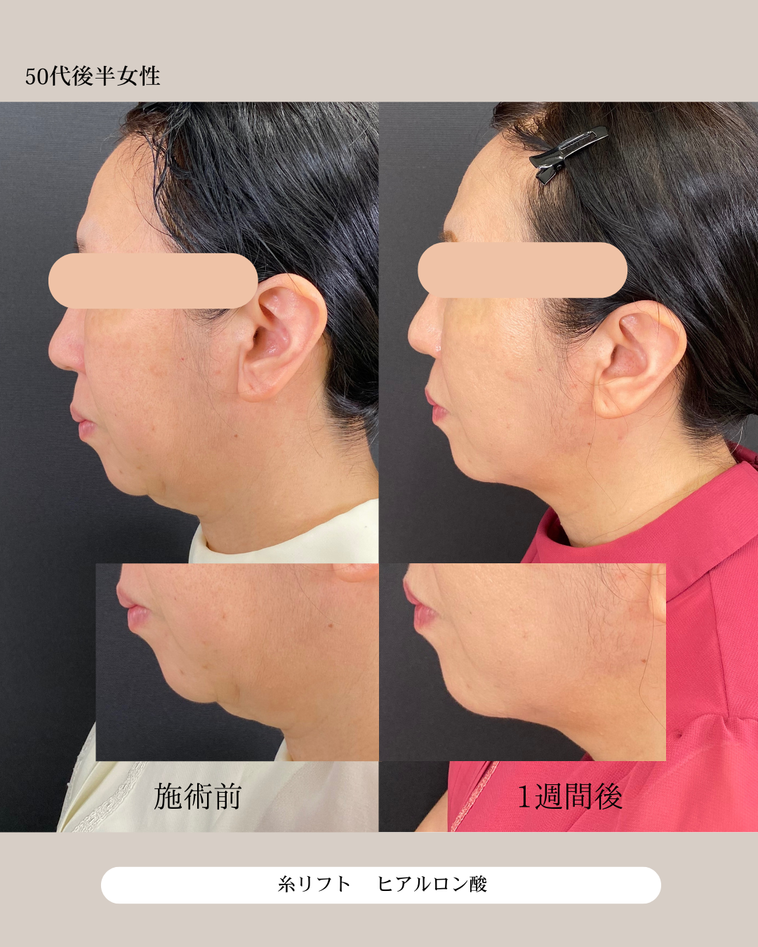 50代後半女性