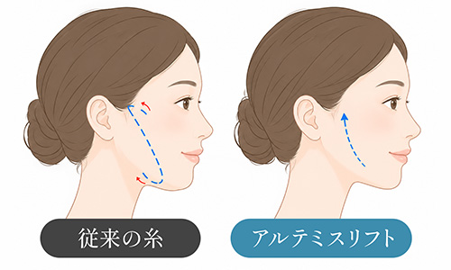 施術の負担を軽減する設計