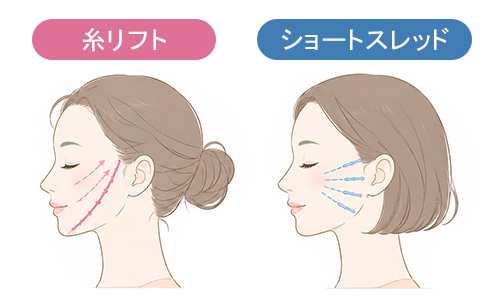 自然で無理のないフェイスラインの引き締め効果