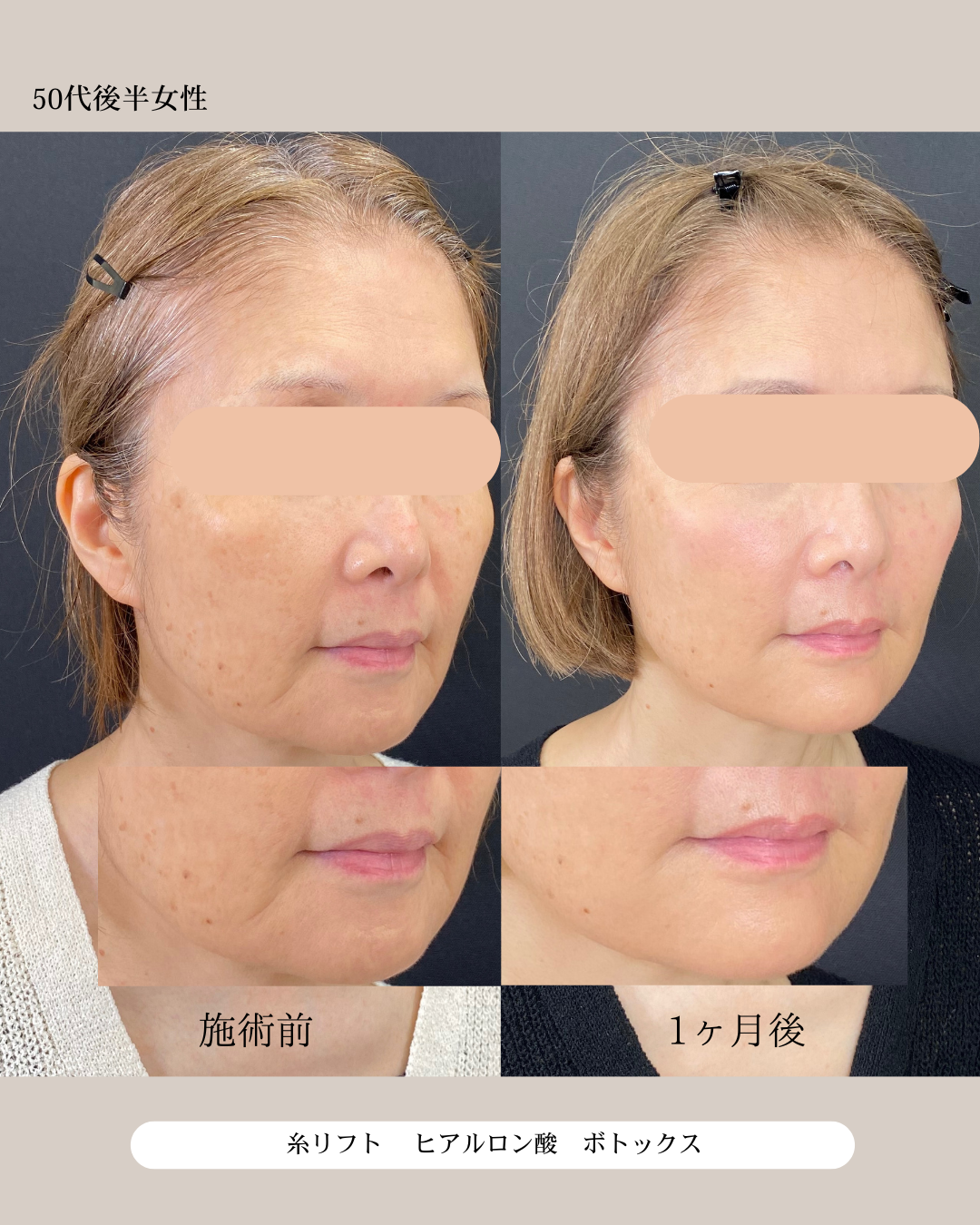 50代後半女性