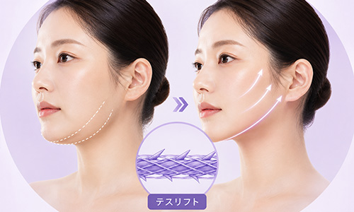 引き締め（タイトニング）と小顔効果の実現