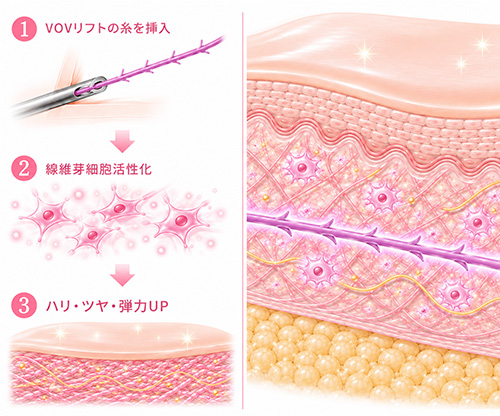 コラーゲン生成を促進